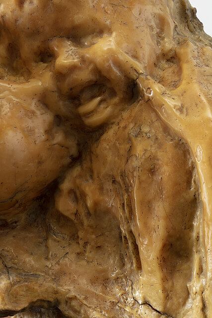 Medardo Rosso Aetas aurea, (Detail), 1886